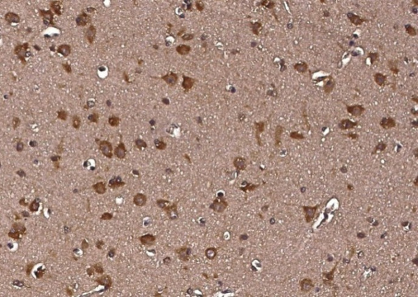 LRPAP1/A2MRAP Monoclonal Antibody (AN200116P)