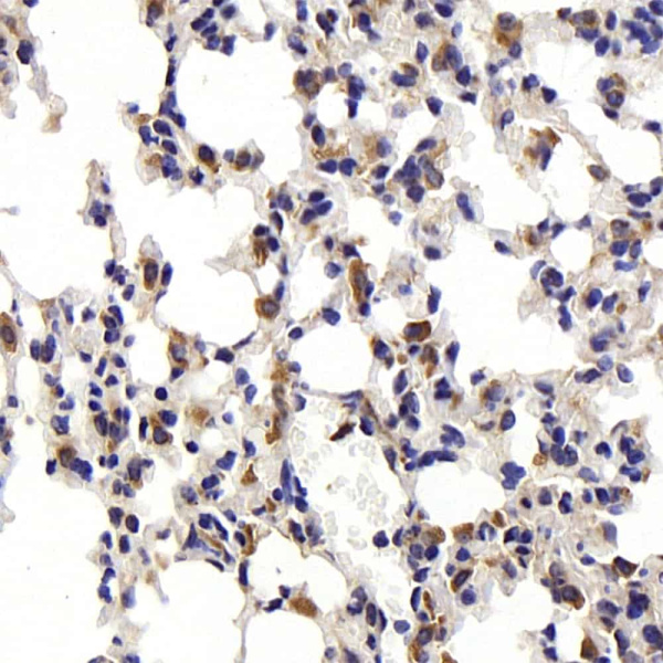 CD68 Polyclonal Antibody (E-AB-70389)