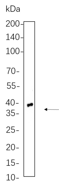 Recombinant TTF1 Monoclonal Antibody (AN300647L)