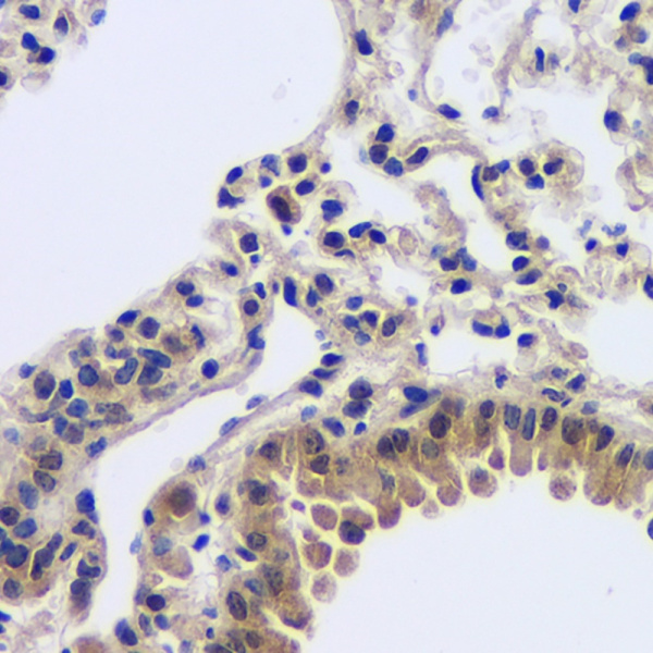 MYD88 Polyclonal Antibody (E-AB-70128)