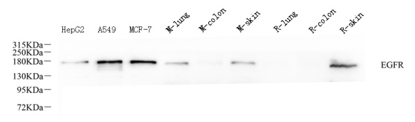 EGFR Polyclonal Antibody (E-AB-70333)
