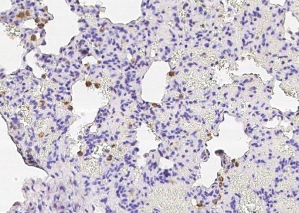 Recombinant CD68 Monoclonal Antibody (AN300590P)