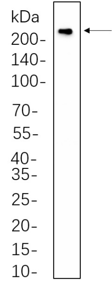 Recombinant VEGF Receptor 2 Monoclonal Antibody (AN301319L)