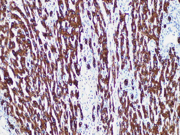CK8/18 Monoclonal Antibody (ELAB6908-R)