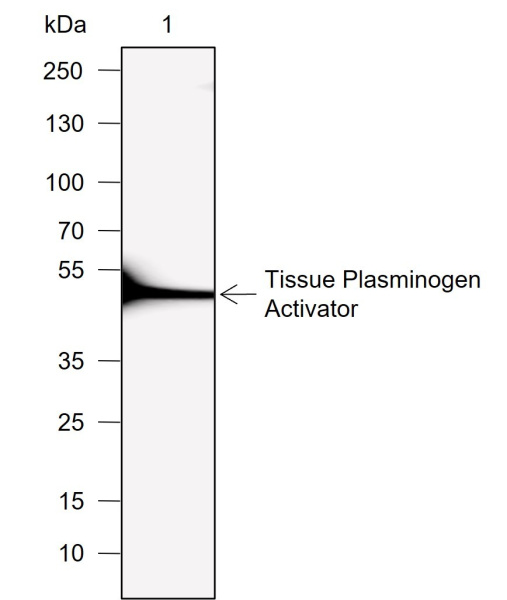 Recombinant Tissue Plasminogen Activator Monoclonal Antibody (AN302005L)