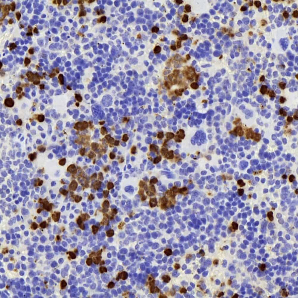 S100A8 Polyclonal Antibody (E-AB-70341)