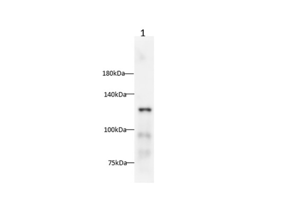 E-Cadherin Polyclonal Antibody (AN004540L)